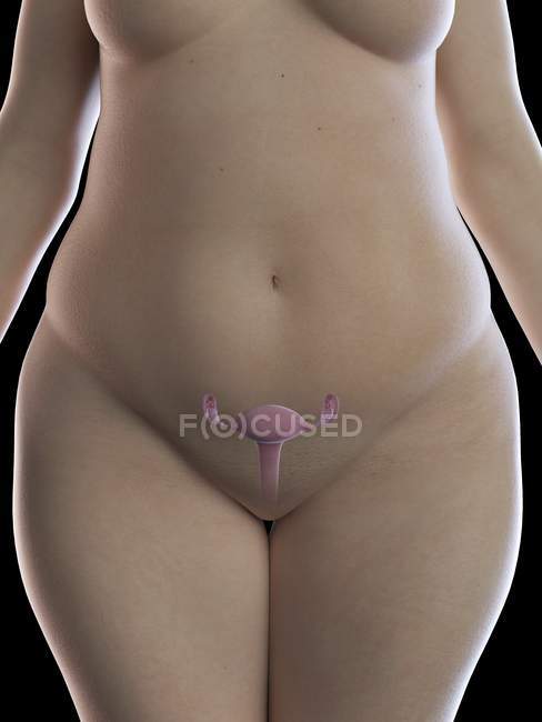 Illustrazione di donna in sovrappeso con utero visibile su sfondo nero . — Foto stock