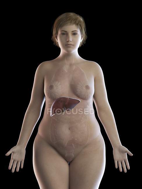 Ilustração de mulher com sobrepeso com fígado visível em fundo preto . — Fotografia de Stock