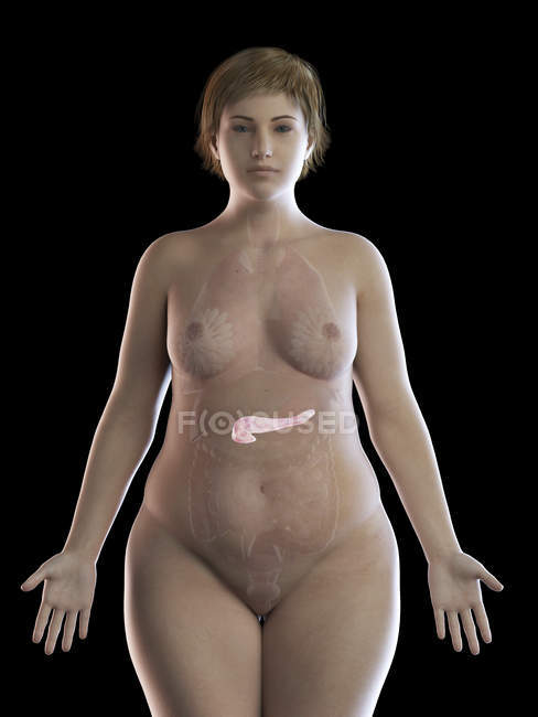 Ілюстрація надмірної ваги жінки з видимою підшлунковою залозою на чорному тлі . — стокове фото
