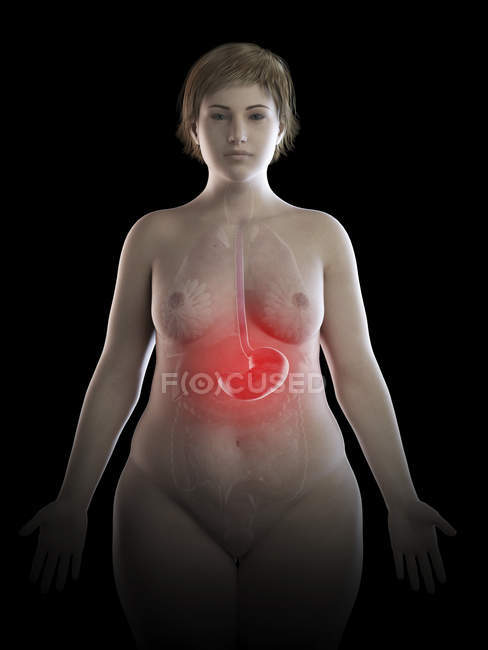 Ilustración de la mujer con sobrepeso con el estómago doloroso visible sobre fondo negro
. - foto de stock