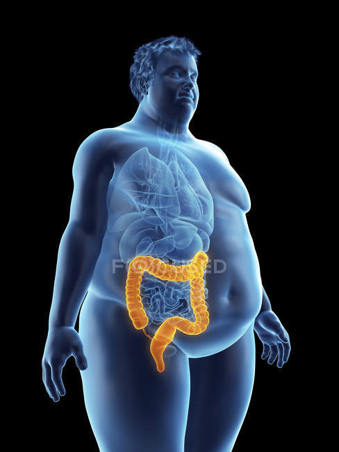Ilustración de la silueta del hombre obeso con colon visible
. - foto de stock