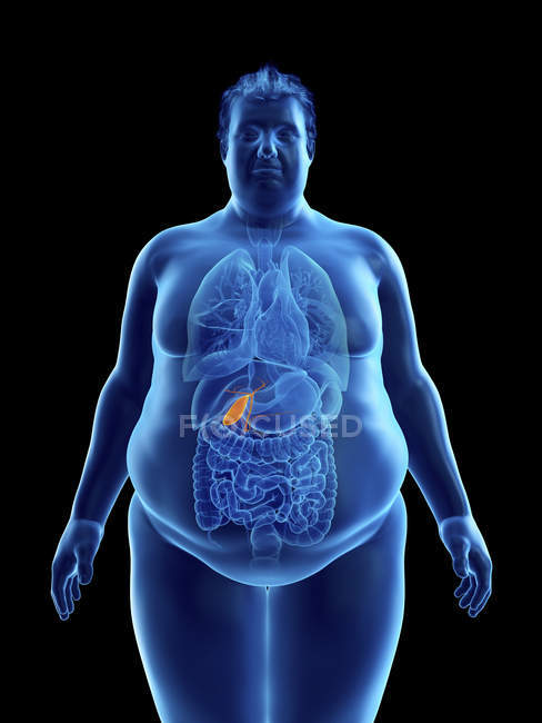 Illustrazione della silhouette dell'uomo obeso con cistifellea visibile . — Foto stock