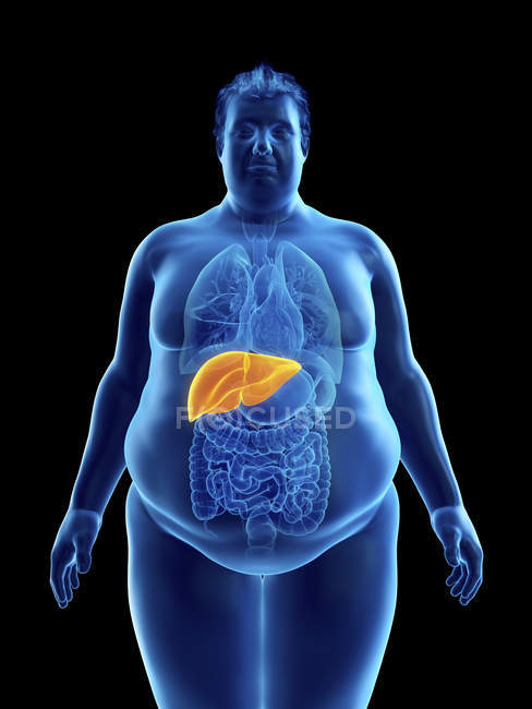Illustration of silhouette of obese man with visible liver. — Stock Photo