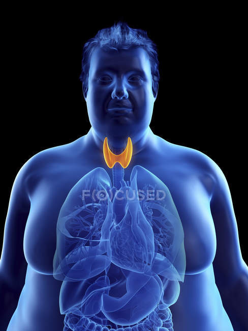 Illustration der Silhouette eines fettleibigen Mannes mit sichtbarer Schilddrüse. — Stockfoto