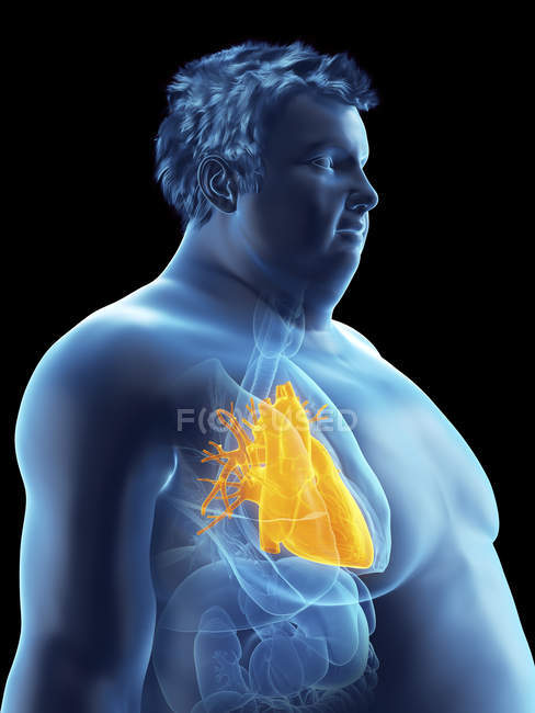 Illustration der Silhouette eines fettleibigen Mannes mit sichtbarem Herzen. — Stockfoto