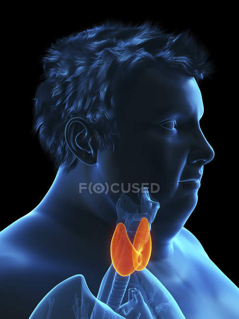 Ілюстрація силуету ожиріння людини з видимою щитовидною залозою . — стокове фото