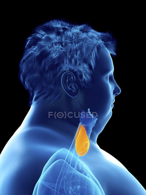 Ілюстрація силует ожирінням людина з видимими щитовидної залози. — стокове фото