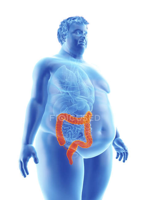 Illustrazione della silhouette dell'uomo obeso con colon visibile . — Foto stock