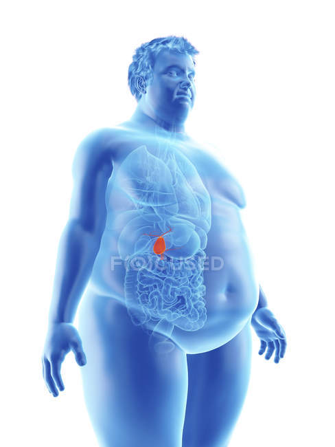 Illustration der Silhouette eines fettleibigen Mannes mit sichtbarer Gallenblase. — Stockfoto