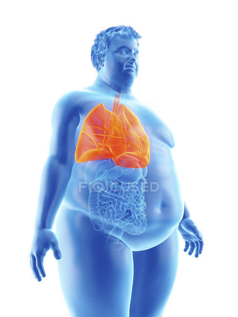 Illustration de la silhouette d'un homme obèse aux poumons visibles
. — Photo de stock
