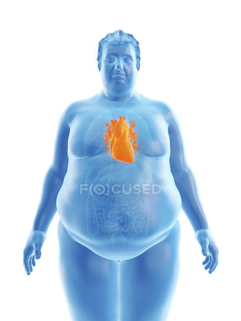 Illustration of silhouette of obese man with visible heart. — Stock Photo