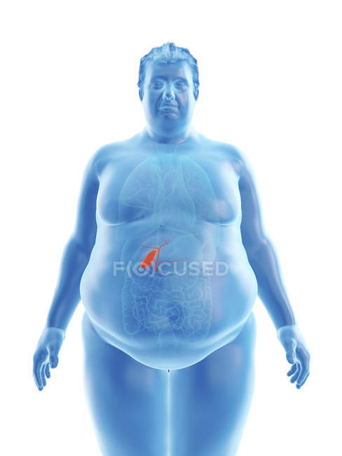 Illustration der Silhouette eines fettleibigen Mannes mit sichtbarer Gallenblase. — Stockfoto