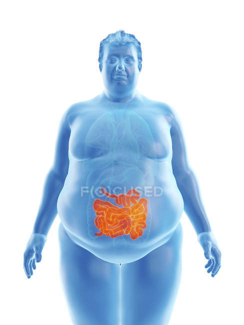 Illustration of silhouette of obese man with visible intestine. — Stock Photo