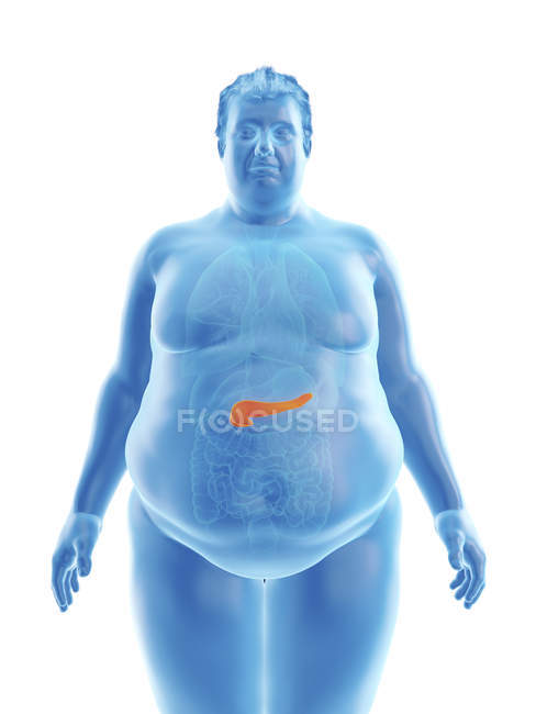 Illustrazione della silhouette dell'uomo obeso con pancreas visibile . — Foto stock