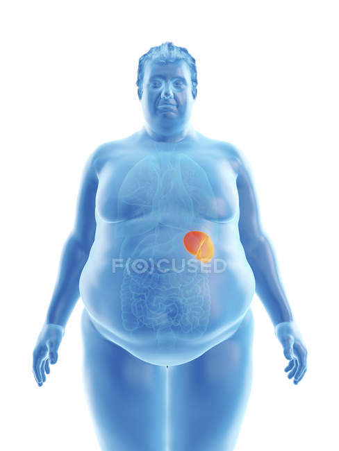 Illustrazione della silhouette dell'uomo obeso con milza visibile . — Foto stock