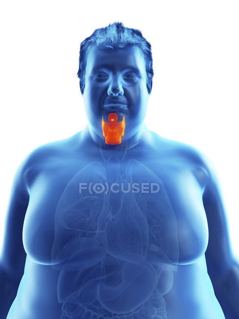 Ілюстрація силуету ожиріння людини з видимим гортані . — стокове фото