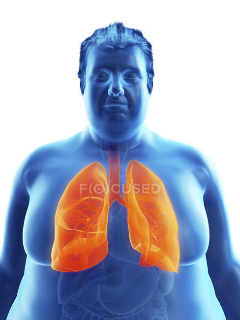 Illustration der Silhouette eines fettleibigen Mannes mit sichtbaren Lungen. — Stockfoto