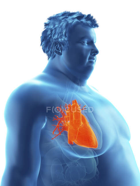 Illustrazione della silhouette dell'uomo obeso con cuore visibile . — Foto stock