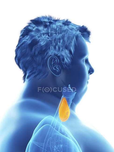 Illustration de la silhouette d'un homme obèse avec glande thyroïde visible . — Photo de stock