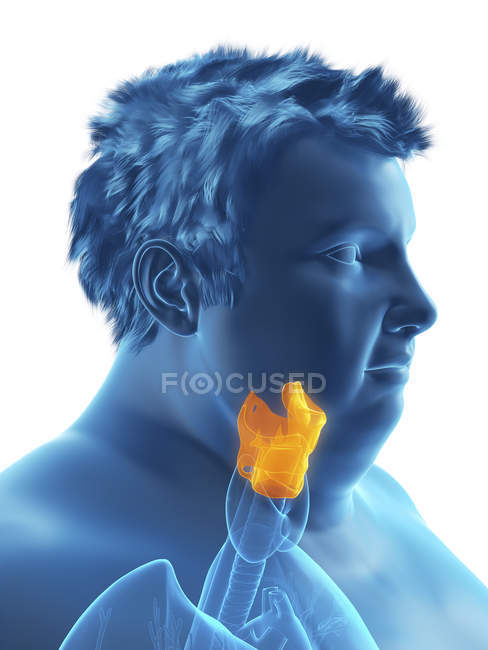 Illustration of silhouette of obese man with visible larynx. — Stock Photo