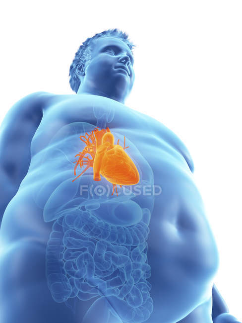 Illustration of silhouette of obese man with visible heart. — Stock Photo