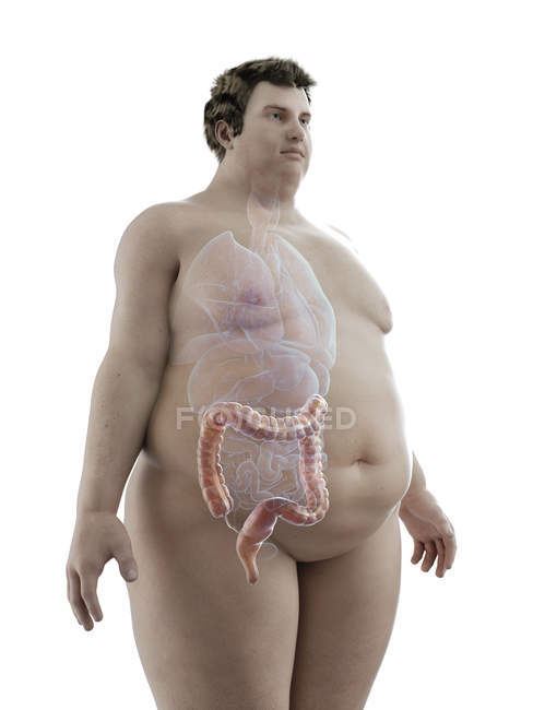 Ilustración de la figura del hombre obeso con colon visible . - foto de stock