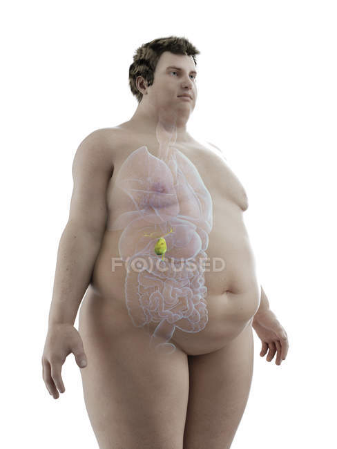 Illustration der Figur des fettleibigen Mannes mit sichtbarer Gallenblase. — Stockfoto