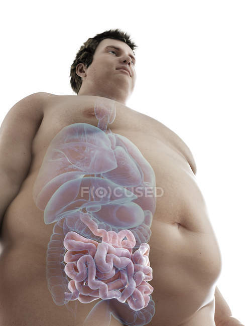 Illustration de la figure de l'homme obèse avec un intestin visible . — Photo de stock