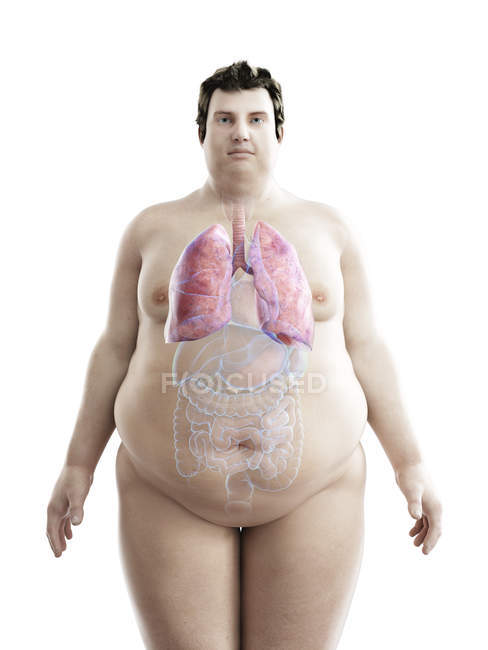 Illustration of figure of obese man with visible lungs. — Stock Photo