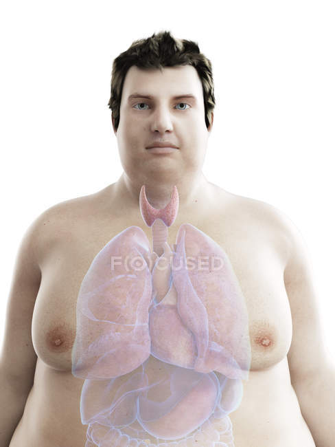 Illustration der Figur des fettleibigen Mannes mit sichtbarer Schilddrüse. — Stockfoto