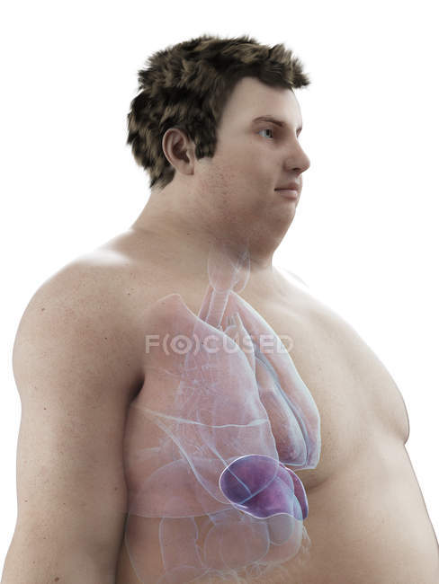 Abbildung der Figur des fettleibigen Mannes mit sichtbarer Milz. — Stockfoto