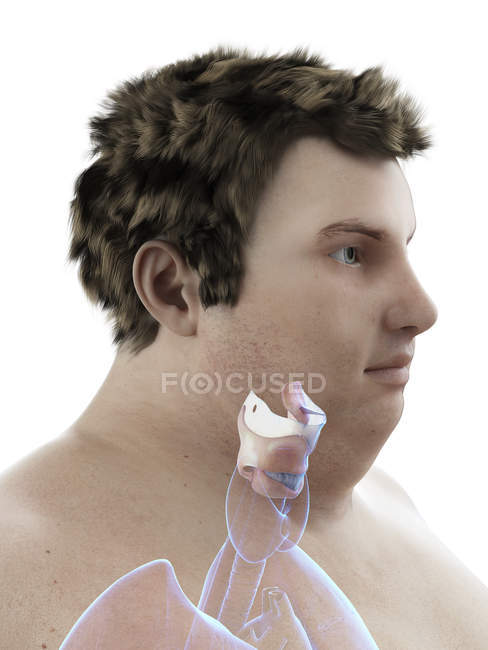 Illustration de la figure de l'homme obèse avec larynx visible . — Photo de stock