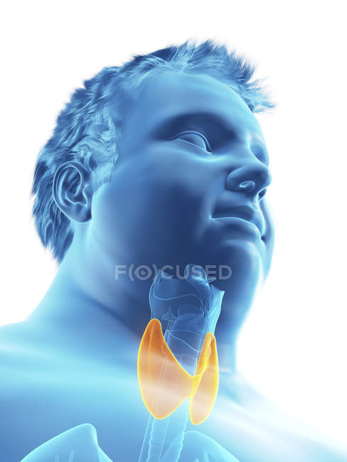Ilustração da figura do homem obeso com glândula tireóide visível
. — Fotografia de Stock