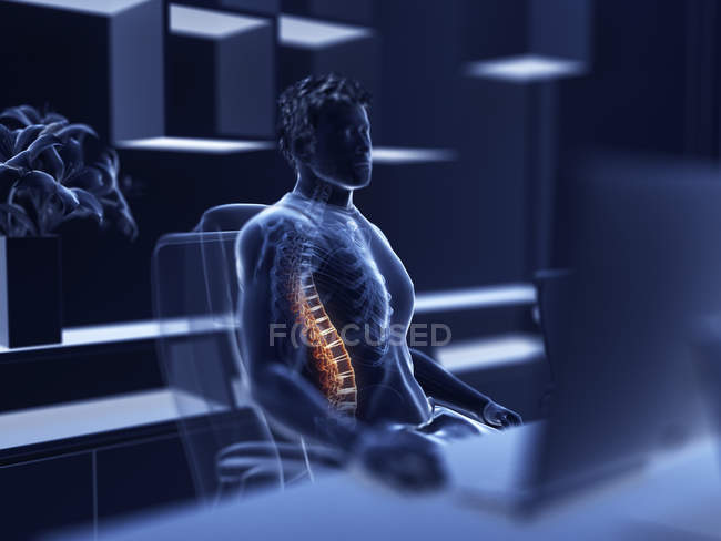 Ілюстрація чоловічого офісного працівника з болючою спиною . — стокове фото