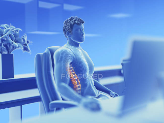 Illustrazione del lavoratore d'ufficio maschile con schiena dolorosa . — Foto stock