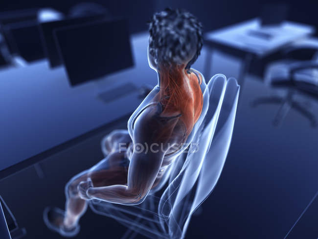 Ilustração do trabalhador de escritório masculino músculos dolorosos . — Fotografia de Stock