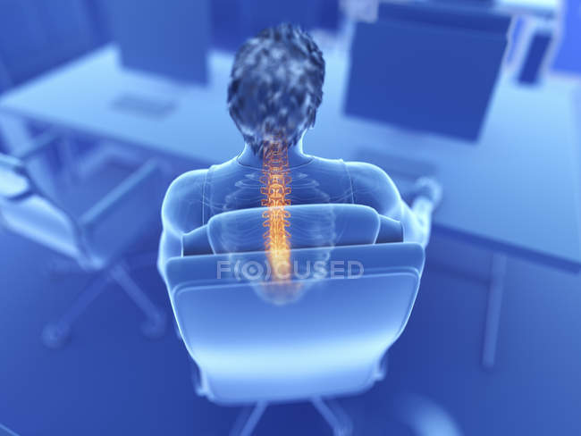 Ilustración de un oficinista masculino con espalda dolorida . - foto de stock