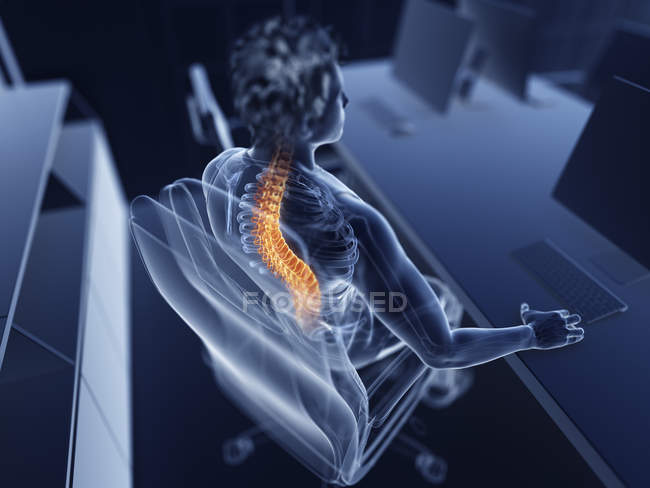 Ілюстрація чоловічого офісного працівника з болючою спиною . — стокове фото