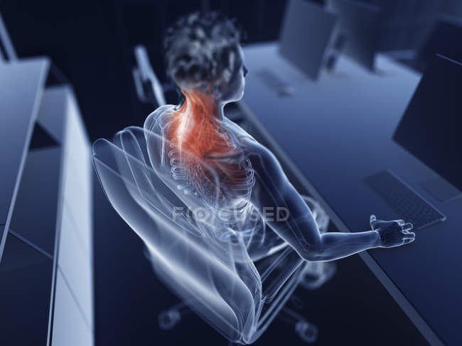Иллюстрация мужского офисного работника болезненные мышцы . — стоковое фото