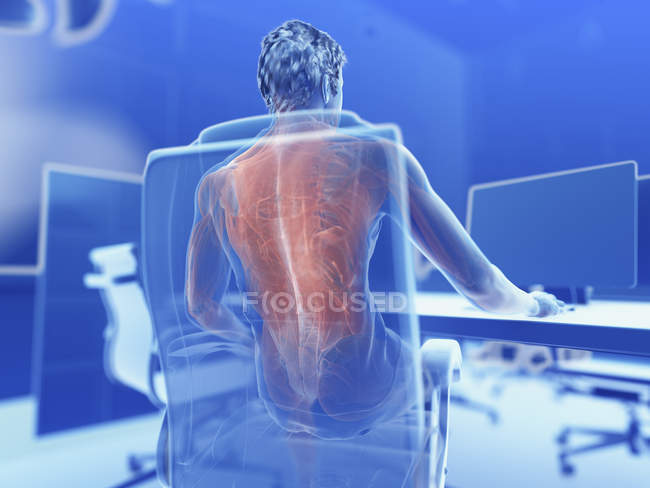 Ilustración de los músculos dolorosos del oficinista masculino
. - foto de stock