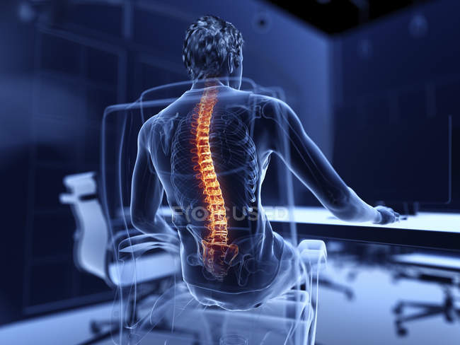 Illustration d'un employé de bureau masculin au dos douloureux . — Photo de stock