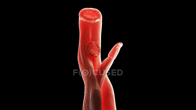 Illustrazione di schistosoma sangue verme piatto trematode su sfondo nero . — Foto stock