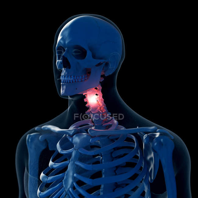 Ilustración digital del cuello doloroso en el esqueleto humano
. - foto de stock