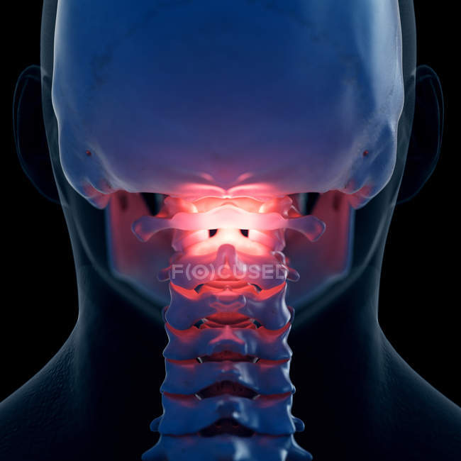 Digitale Illustration schmerzhafter Atlasknochen im menschlichen Skelett. — Stockfoto