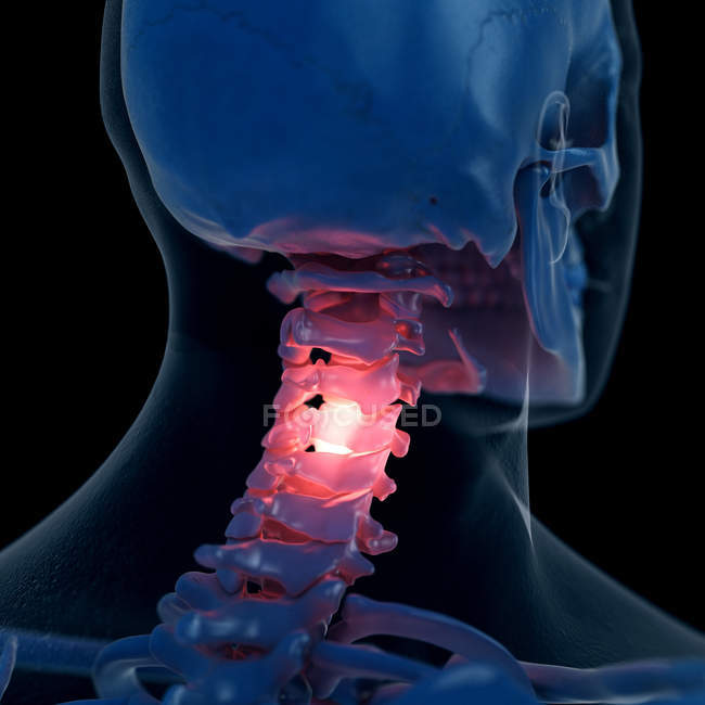 Ilustração digital do pescoço doloroso no esqueleto humano
. — Fotografia de Stock