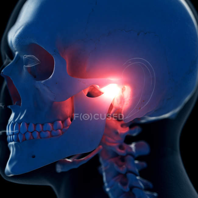 Illustration numérique de l'articulation temporomandibulaire douloureuse dans le squelette humain . — Photo de stock