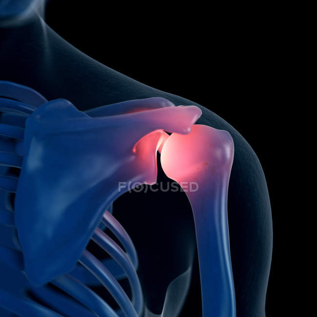 Цифровая иллюстрация болевого плеча в скелете человека . — стоковое фото