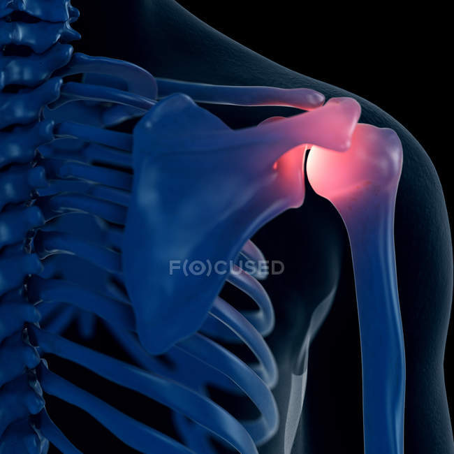Цифровий ілюстрація хворобливі плече в скелет людини. — стокове фото