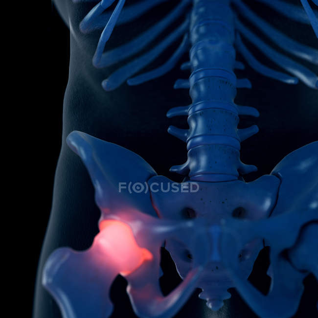 Ilustración digital de la articulación dolorosa de la cadera en esqueleto humano . - foto de stock