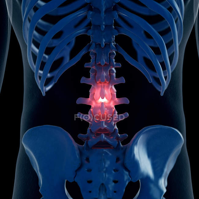 Digitale Illustration der schmerzhaften Lendenwirbelsäule im menschlichen Skelett. — Stockfoto